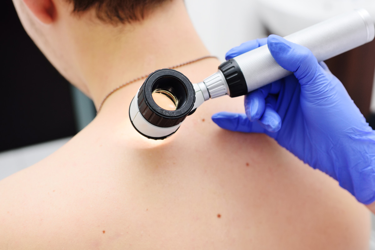 dermatoscopia